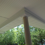 Northport - Columns, Stairs, Trim Boards & Lattice